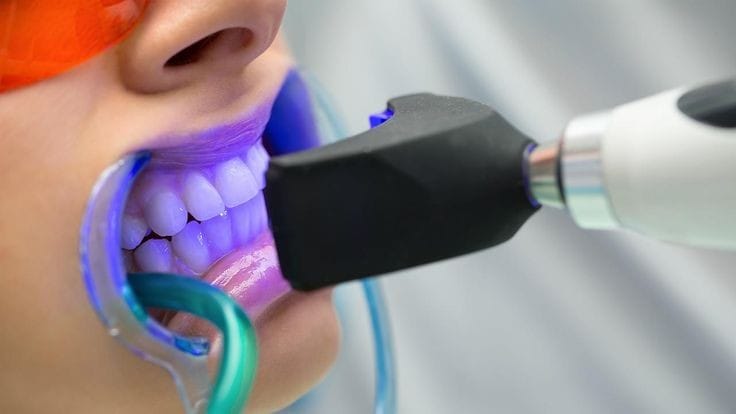 Teeth Bleaching Dentist at Dental Care Centre