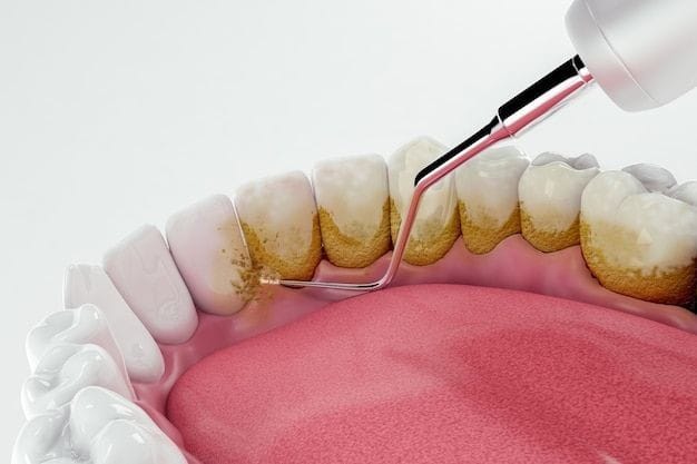 Teeth cleaning near me: To get a radiant confident smile with healthy teeth.