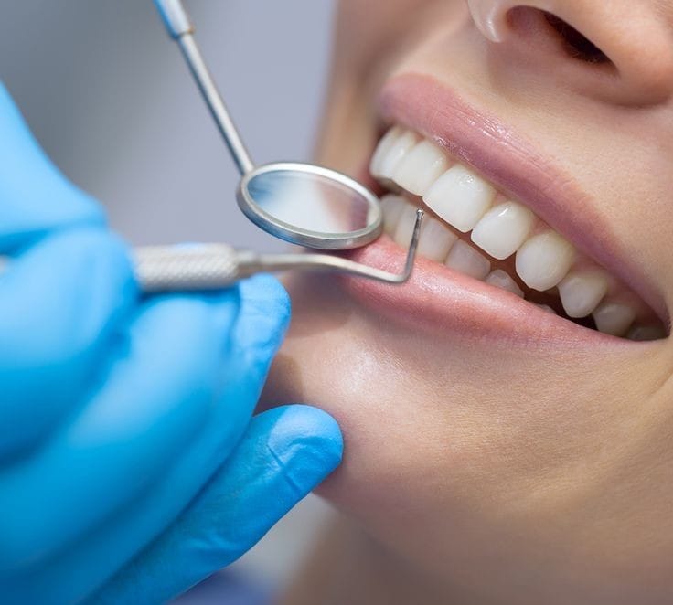 Regular Dental check-ups – The secret for a lasting smile