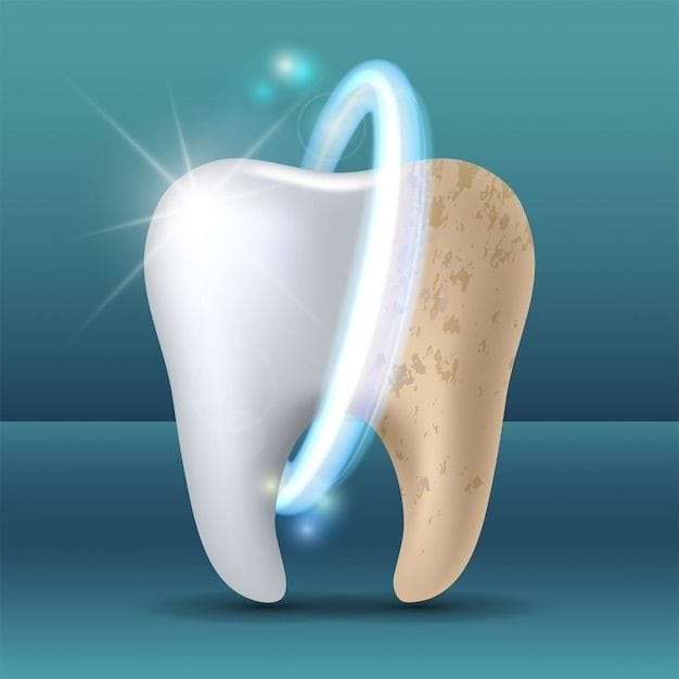Opalescence tooth whitening Sparke with confidence