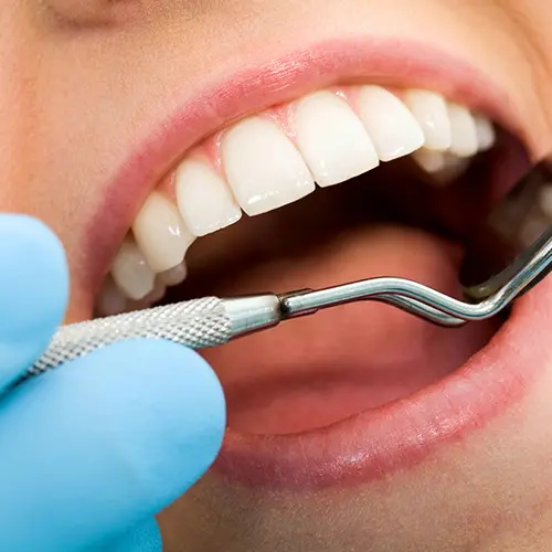 TEETH GRINDING – Essential Information