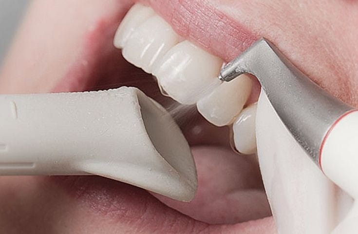 Experience the Freshness with Airflow Dental