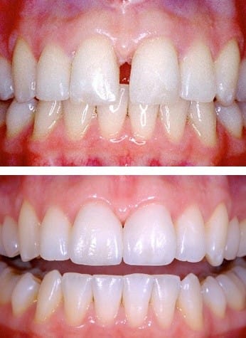 The Art of Restorative Dentistry