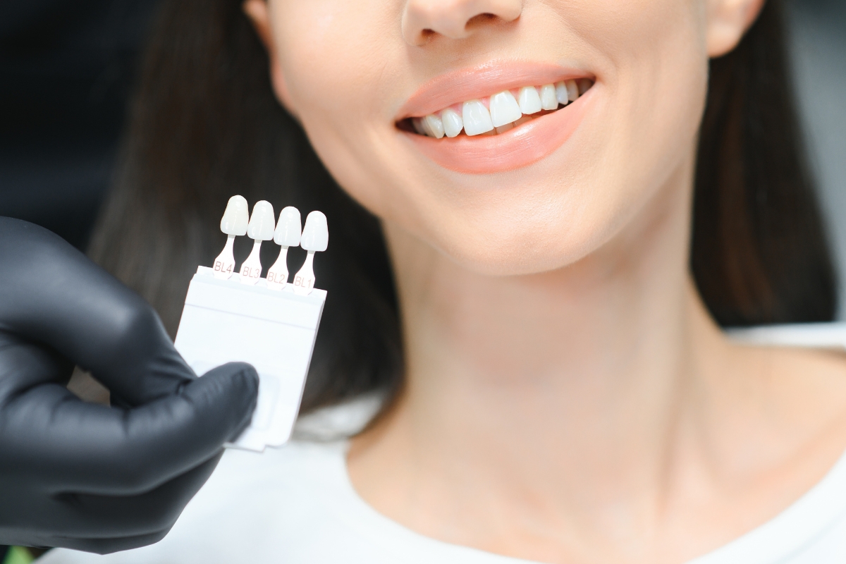 Should I get veneers or a whitening treatment?