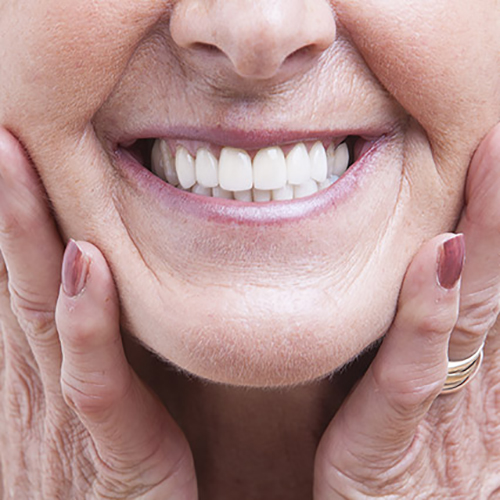 Smilemakeovers Dental-Treatment