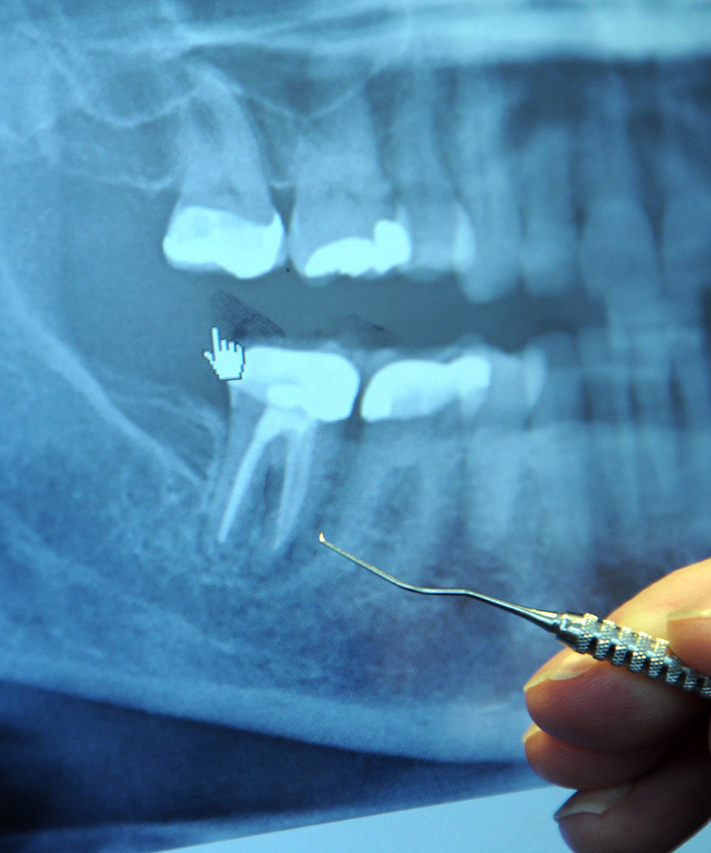 dental-care-center-Digital-x-ray-home1