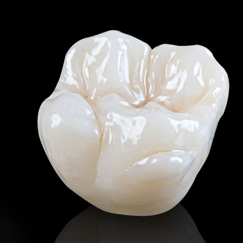 dental-care-center-crowns