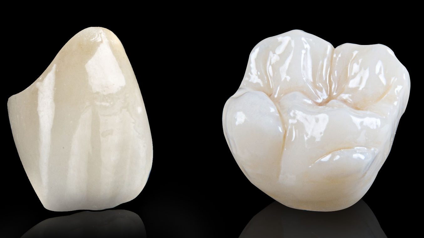dental-care-center-crowns