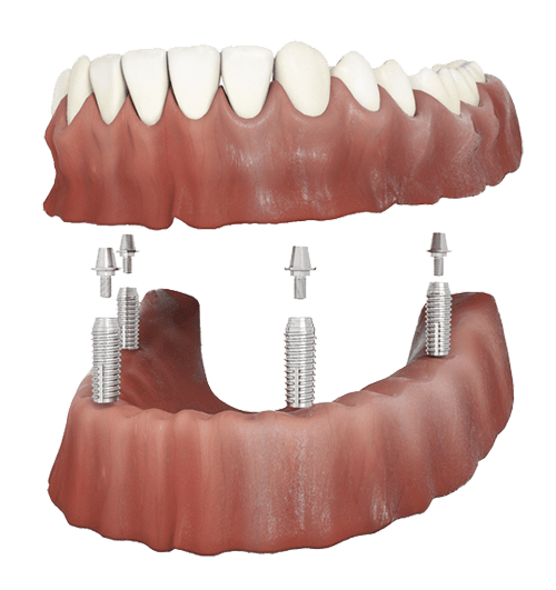 dental-care-center-retained