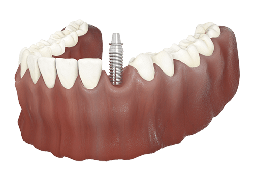 dental-care-center-single