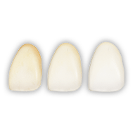 dental-care-center-veneers-single