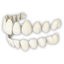 dental-care-center-veneers_botharches
