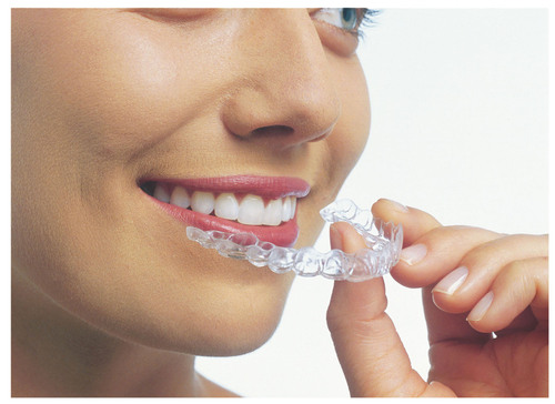 peckham-invisalign