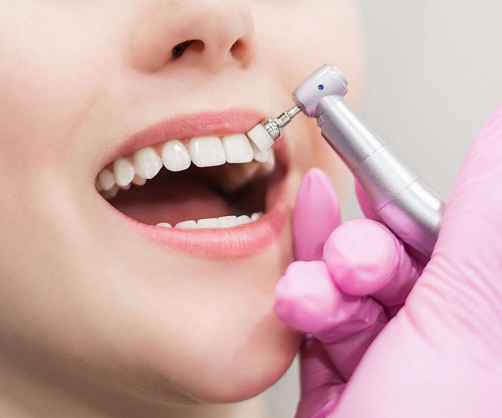 Dental Hygienist New Cross Dental Treatments London