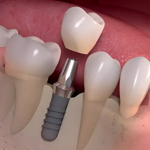 dentist-aldgate-04