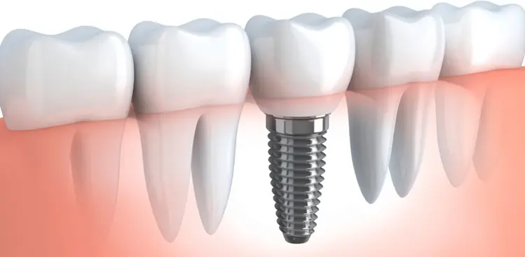 dentist-in-covent-garden-03