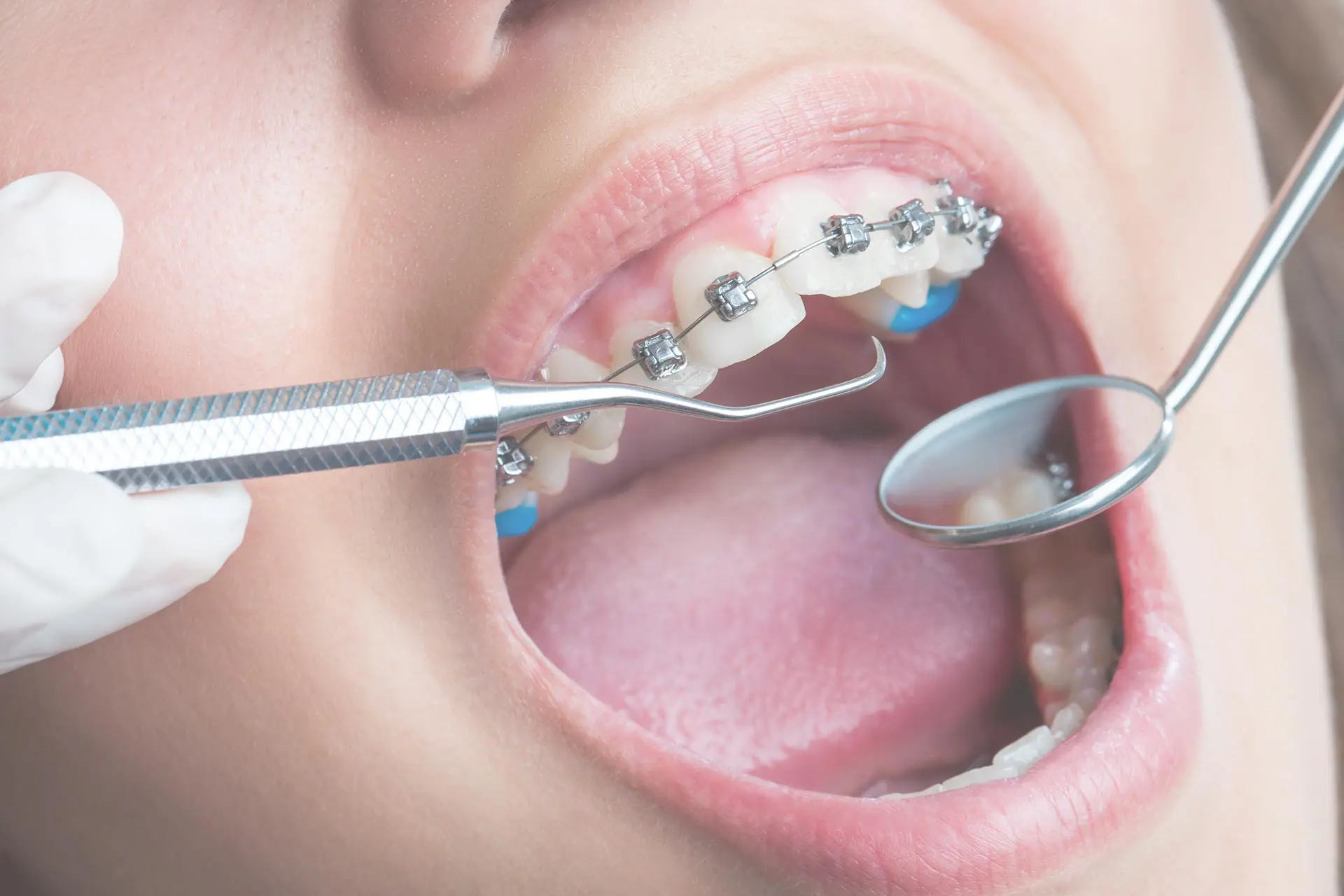 dentist-in-poplar-6