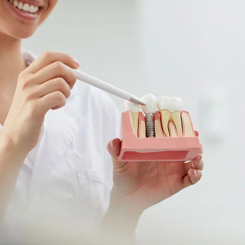 dentist-in-streatham-7