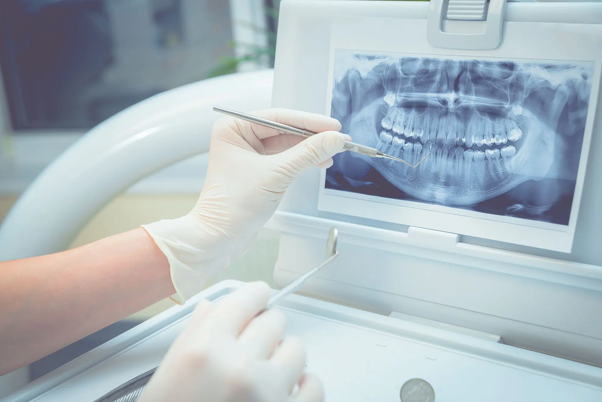 dentist-in-tooting-1