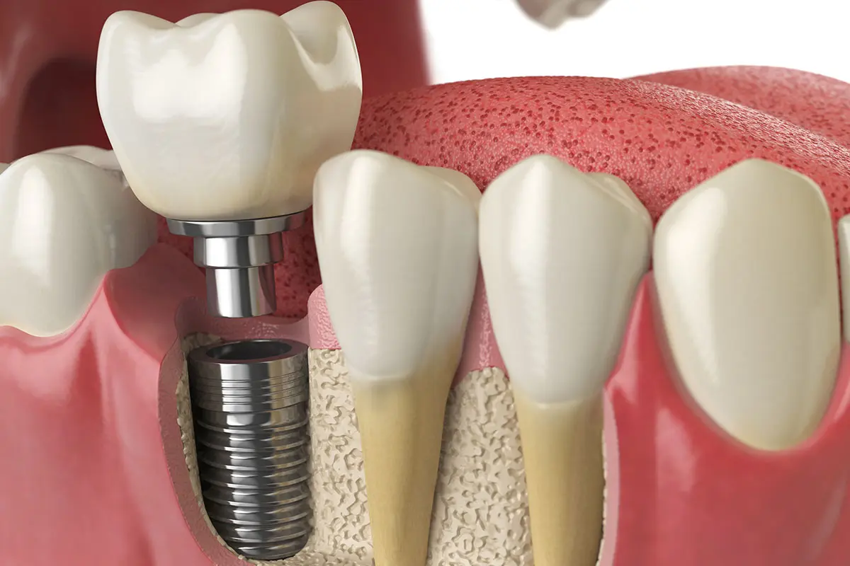dentist-notting-hill-7