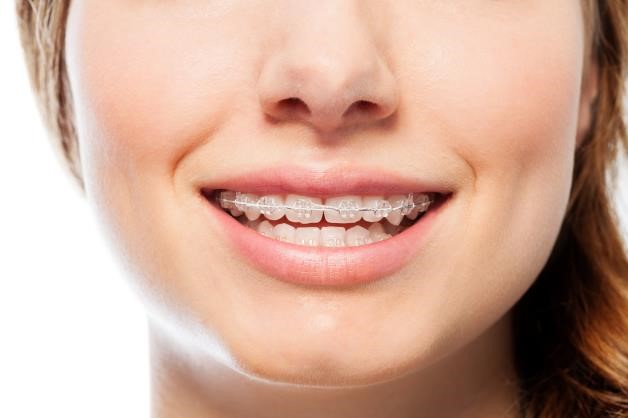 six-month-smile-01