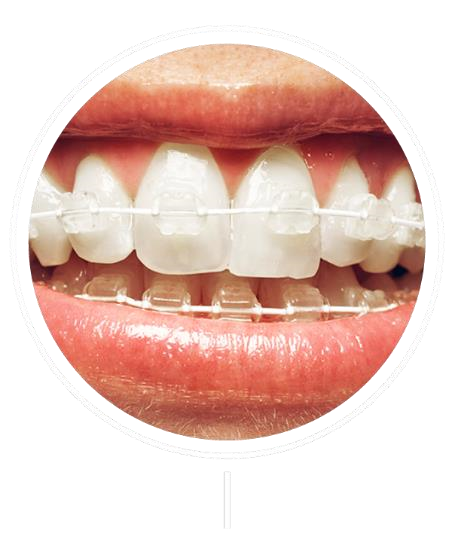 six-month-smile-03