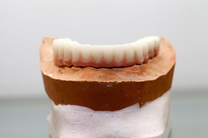 edentulous-lower-jaw-1